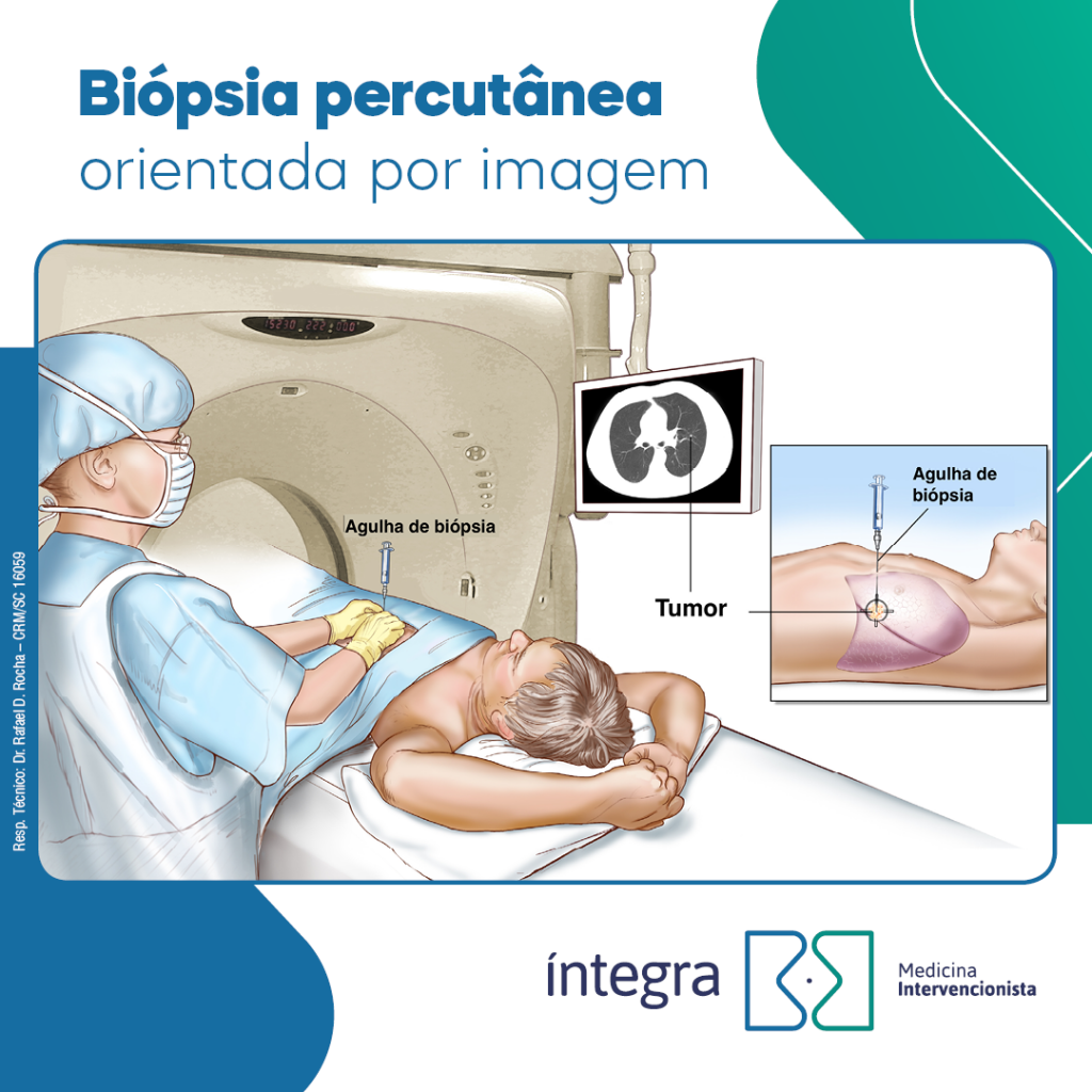 Biopsia percutanea orientada por imagem